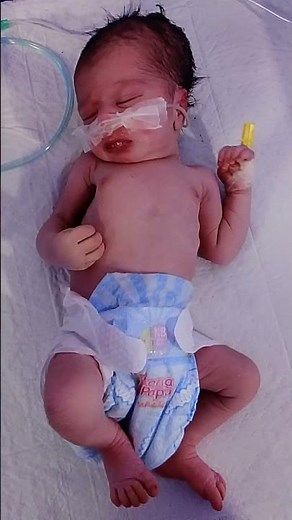 🧠 Newborn Baby HIE (Hypoxic-Ischemic Encephalopathy)