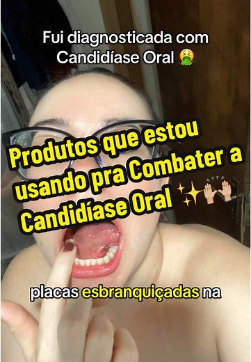 #candidiase #candida #fungos #fungosnaboca #boca #saude #candidiaseoral #candidiasevaginal #imunidade #afta #corrimento #saudeoral #oral #dentista