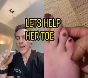 Hammertoe Fix: Would You Help This Toe?