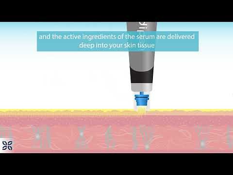 The Cosmetic Clinic - What is MesoInfus Micro Needling?