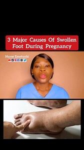 45K views · 1.2K reactions | Causes of swollen foot during pregnancy. #nurse_emetuobi #e#emetuobi #nurse_emetuobi #pregnancylife #pregnant #nurse #healthylife #fypシ゚ #fypシ゚viralシ #foryou #foryoupage #foryourpageシ | Borat Medicals | Facebook