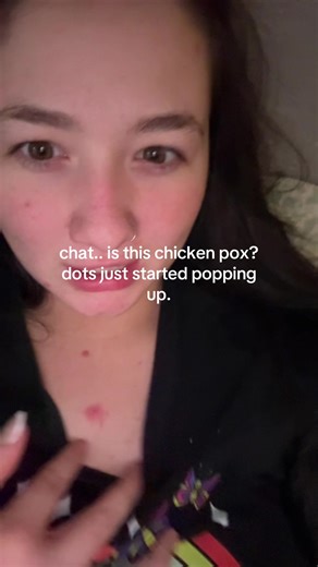 i don’t get chest acne what is happening.. the dots are appearing EVERYWHERE HELP ME. (yes i’ve been sick for a few days) #chickenpox #help #askingforafriend #illness #sick