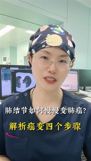 肺结节是如何慢慢变成肺癌？详细解析肺结节癌变的步骤#肺结节#肺癌#抖出健康知识宝藏#抖音医学院#肺癌 #中国医师节 #走进生命线
