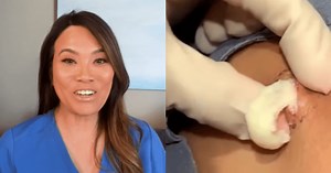 'Dr Pimple Popper: A Pimple Carol': Top 5 most satisfying Dr Sandra Lee videos