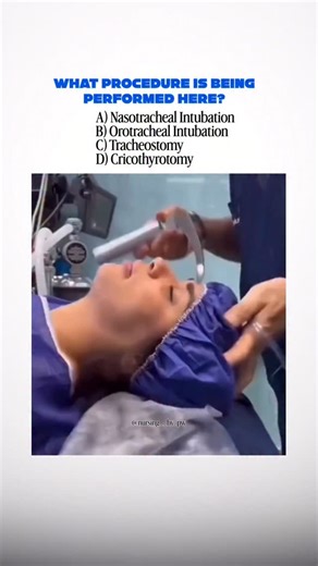 Nursing Wallah on Instagram: "What it is: Orotracheal intubation is a life-saving airway management procedure where a tube is inserted through the mouth into the trachea to maintain an open airway. Why we do it: • To help patients who can’t breathe on their own (e.g., during anesthesia, trauma, or respiratory failure). • To secure the airway and prevent aspiration. • To connect the patient to a ventilator for assisted breathing. How it’s done: 1. The patient is positioned with the head tilted ba