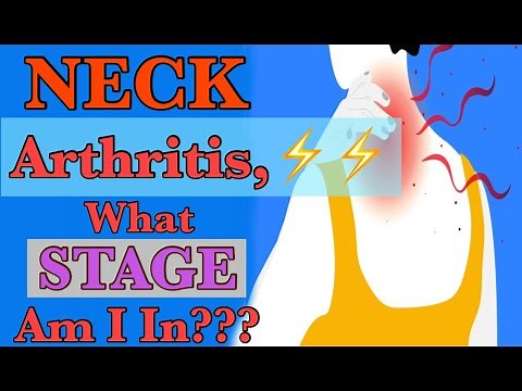 Neck Arthritis (2024) | Stages of Degeneration | Dr. Frank Altenrath Chiropractor in Cresskill, N.J.