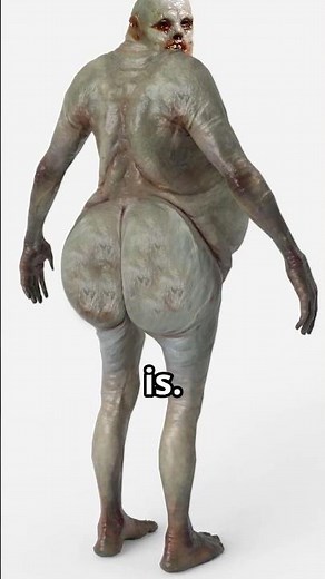 Why is the State of decay 2 Bloater so weak?