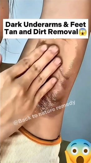 Rid Dark & Smelly Armpits Fast ✨ | Easy Underarm Cleaning Tips & Tricks 🌿#DarkArmpits #ytshorts