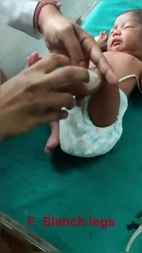 How to check for jaundice/icterus in a newborn?