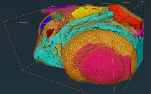 【Avizo/Amira小Demo】 通过分水岭方法，挖取不规则的图像并进行鱼类软骨分割和制作动画