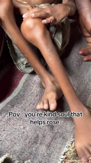 Imagine your support turning into a child’s first steps. 👣 With your support, this baby can walk, play, and smile again. 🌈 Let’s bring hope where it’s needed most. 💖 #SupportTheKids #NonprofitUSA #HelpKids #TogetherWeCan #ChangeLives