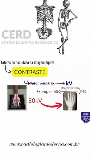 Wrong kV / Radiological Techniques