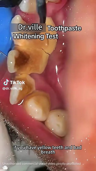 Dr.ville_Sg on TikTok