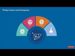 Philips Ultrasound Fusion and Navigation Value Proposition