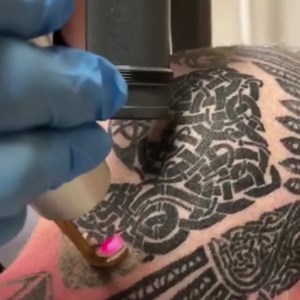 16 reactions | Curious about tattoo removal? Get your head in the game and sign up for a free consult! | Removery | Facebook