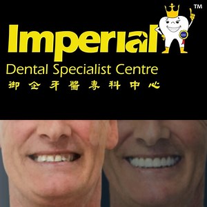 11 reactions · 7 comments | Full mouth rehabilitation 醴 The patient...