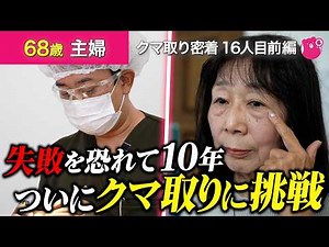 【目の下のクマ取り】失敗が怖くて選び抜いた先生は・・・[クマ取り密着16人目前編]#目の下のたるみ取り#美容整形#表ハムラ#切開ハムラ#クマ取り整形#湘南美容クリニック