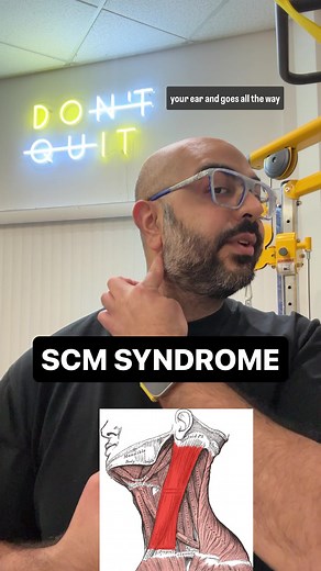 🚨STERNOCLEIDOMASTOID SYNDROME🚨 - 🧠 Did you know your neck pain, headaches, or dizziness could be linked to a little-known condition called Sternocleidomastoid (SCM) Syndrome? This syndrome involves the muscle stretching from your sternum and clavicle to behind your ear. Symptoms can vary from neck stiffness, headaches, and balance issues to visual disturbances and ear ringing. But don’t jump to conclusions yet! ⚠️ Here’s the catch: These symptoms might mask more serious health issues. Sudden 
