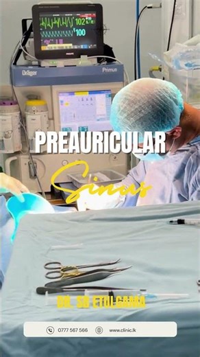 Preauricular Sinus Excision | Dr S. B. Etulgama | Safe & Precise ENT Surgery in Kandy