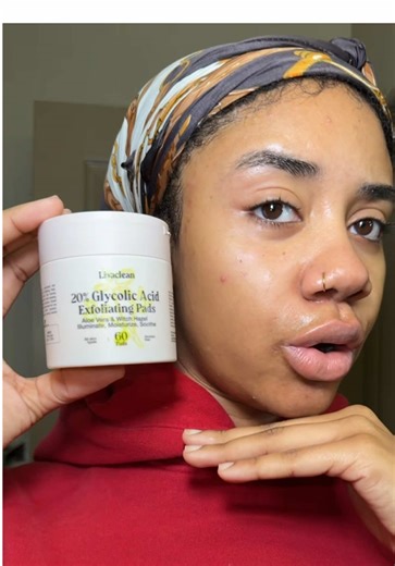 This has 20% glycolic acid, green tea, witch hazel, & aloe vera!!!😭👏🏾 SKIN LOVES IT