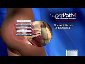 Superpath Presentation