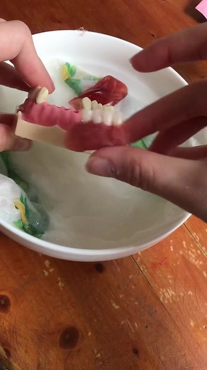 Emergency Dentures Crafting Tutorial | Dentix Solutions