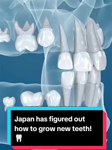 Japan has figured out how to grow new teeth! 🦷 Scientists in Japan have discovered a way to regrow real human teeth. They found that our gums contain “dormant tooth buds” — and created a drug that activates their growth by blocking the USAG-1 protein, which prevents tooth development. In mice and ferrets, new teeth have already grown, and now the first human trials are beginning. If everything goes well, implants and dentures may become a thing of the past. The future of dentistry is starting r