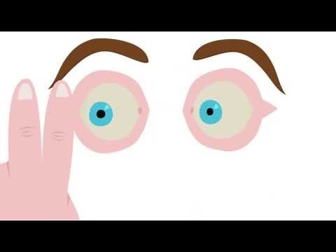 Hoe werkt EMDR? Een animatie