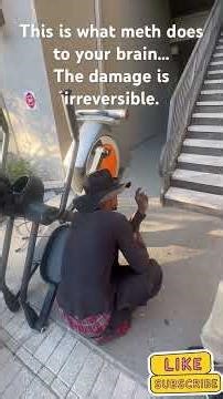 This is what drugs do to you. #drugs #crazy