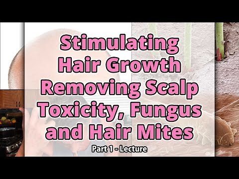 Stimulating Hair Growth Removing Scalp Toxcity, Fungus & Hair Mites Part 1 | Dr. Robert Cassar