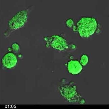 H2O2-induced necrotic L929 cells - Morphology, ROS & PI uptake overlay