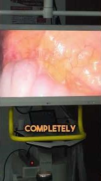 Hidden Pelvic Infection!