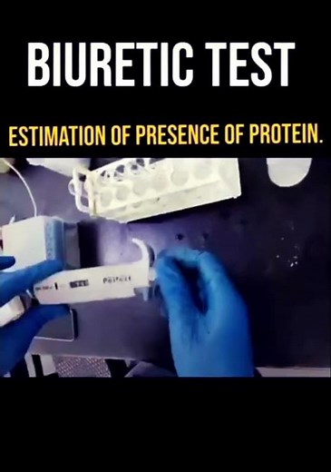 Biuret test for protein#biotechnology#biochemistry