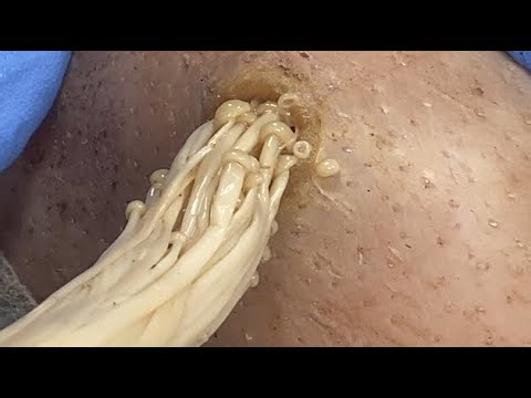 𝑭𝒂𝒄𝒊𝒂𝒍 𝑪𝒍𝒆𝒂𝒏𝒔𝒊𝒏𝒈 𝑭𝒂𝒄𝒆𝒐𝒇𝒇 𝑴𝒊𝒄𝒆𝒍𝒍𝒂𝒓 𝑾𝒂𝒕𝒆𝒓 𝒗𝒔 𝑪𝒍𝒆𝒂𝒏𝒔𝒊𝒏𝒈 𝑶𝒊𝒍 0936