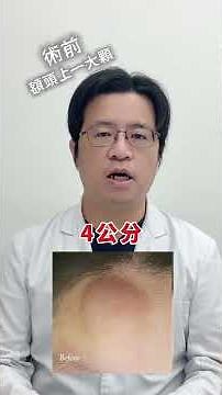 粉瘤脂肪瘤大不同!