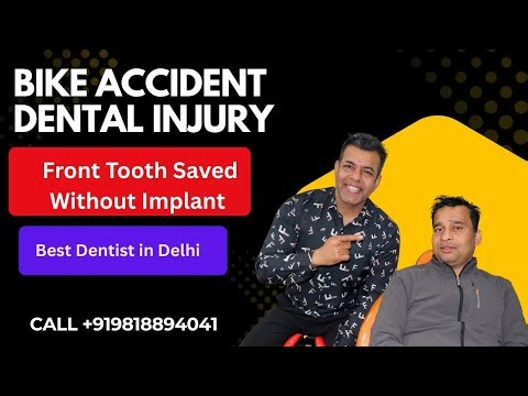 Dental Trauma Management After Bike Accident Tooth Avulsion & Fracture Treatment | Emergency Dentist