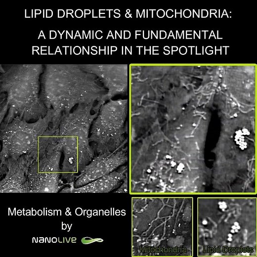 label free live cell imaging lipid droplets and mitochondria relationship at high resolution