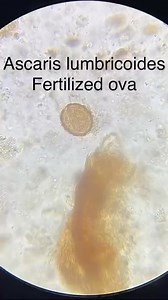 Stool sample 😲😲🔬 Lab life #medicaleducation #microbiologylab | Lab life
