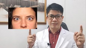 41K views · 644 reactions | To save time explaining STRABISMUS THERAPY, here's a video that covers it well. | Lusung Vision Therapy and Phototherapy Clinic | Facebook