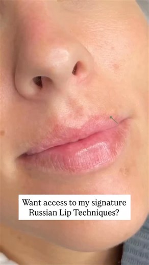 14K views · 99 reactions | I used to think flat lips were all about...