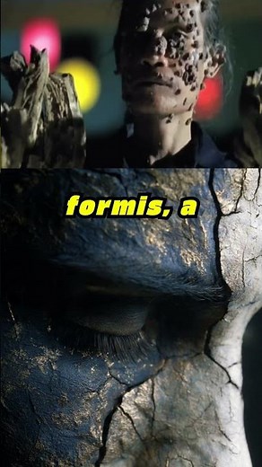 His Body Turned Into a Tree #medical #rare