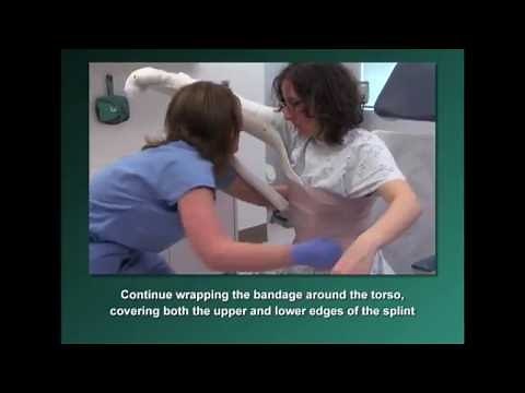 Burns 401: Axillary Splints