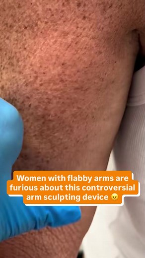 Sagging arms? Try Myoglow Arm Lifting Device - it’s a game changer. If your arms have started to sag or jiggle more than you’d like, you’re not alone. And it’s not just fat — it’s often loose skin, which diet and workouts alone won’t fix. That’s why thousands of women are using the Myoglow Arm Lifting Device to visibly tighten and tone their arms in just 5 minutes a day. 👉 Targets underarm sag and flabby triceps 👉 Firms and smooths skin with gentle stimulation 👉 Backed by Harvard-supported te