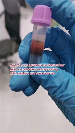 Microtainer tubes are used to collect small volume of blood