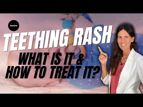 TEETHING RASH: What Is It & How To Treat It?