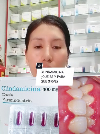 Clindamicina: ¿Qué es y para qué sirve en medicina?
