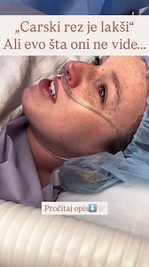 Oni ne vide trenutak kada ležiš na stolu, ruck raširenih, nepokretna, nadajući se da će sve proći kako treba. Oni ne osećaju pritisak dok ti telo povlače i pomeraju, dok si potpuno budna i moliš se da čuješ taj prvi plač. Oni ne osećaju drhtavicu, mučninu, težinu tela koje odjednom više ne osećaš kao svoje. Oni ne osećaju oštar bol svaki put kada ustaneš, nasmeješ se, zakašlješ ili pokušaš da podigneš svoju bebu. Oni ne vide mesece utrnulosti, ožiljak koji boli u hladnim danima, tihu brigu zbog 