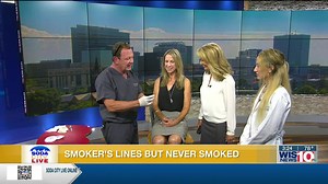 Soda City Live: Why do you have smoker’s lines when you never smoked?