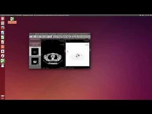 RadiAnt DICOM Viewer on Linux
