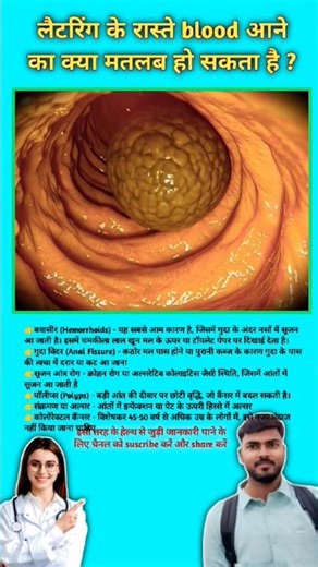 What could be the meaning of bleeding through urination? Reason for rectal bleeding || #viral #piles